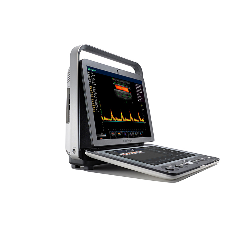 <strong>AN-S9 Portable color Doppler </strong>