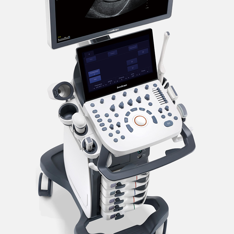<strong>AN-P20 Color Doppler Ultrasou</strong>