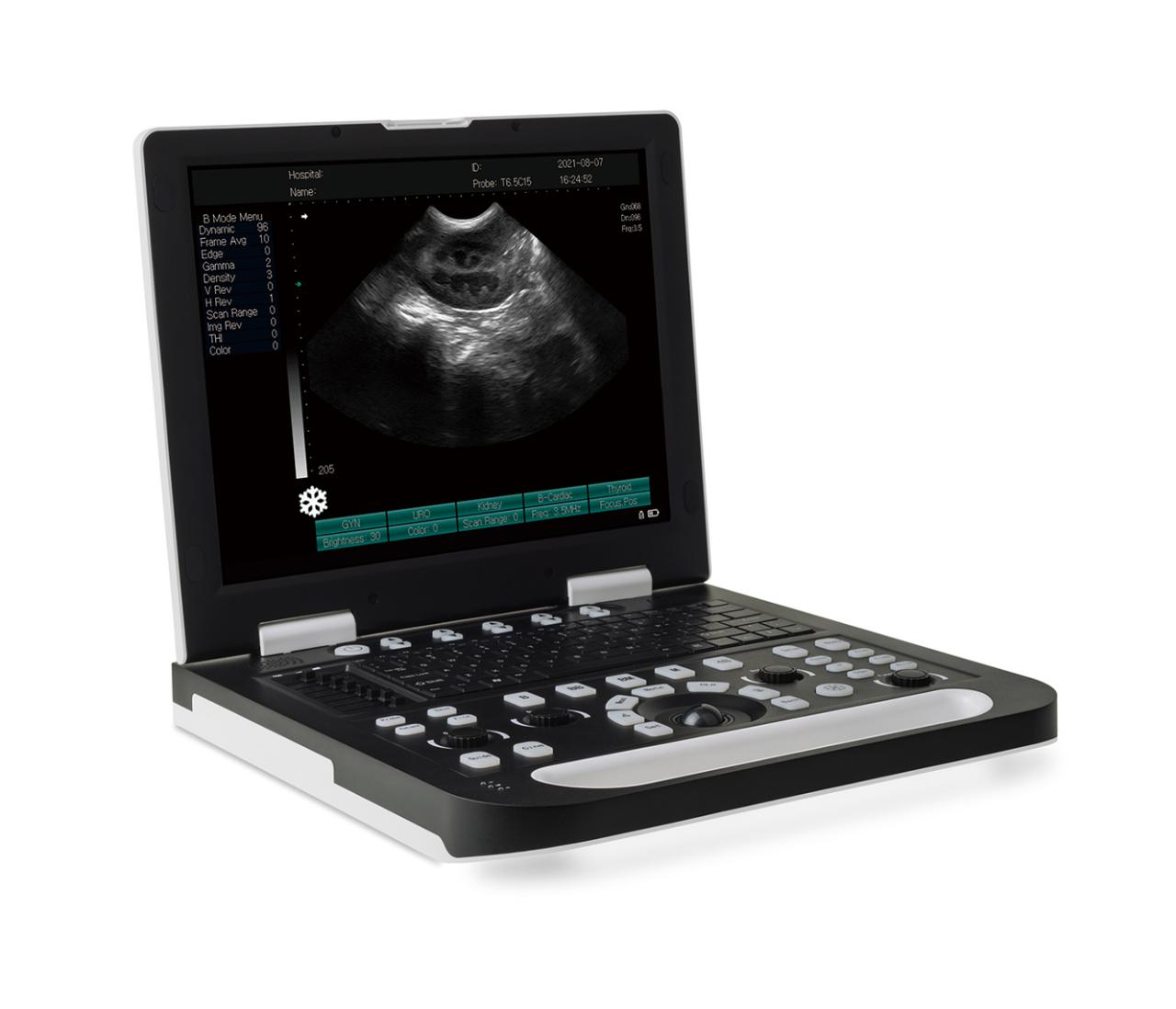 <strong>AN-RS-N50 (VET) all-digital notebook ultrasound diagnostic i</strong>