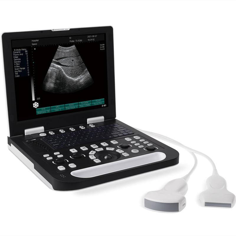 <strong>AN-RS-N50 full digital notebook ultrasound diagnostic instru</strong>