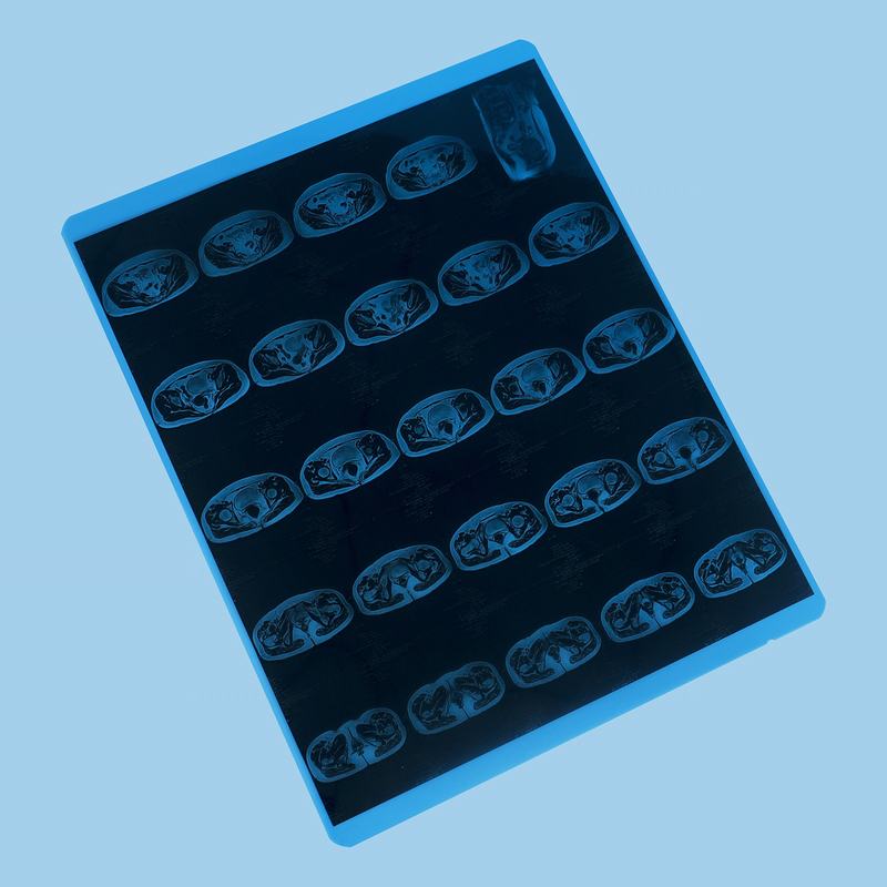 <strong>Laser Film (White & Blue)</strong>